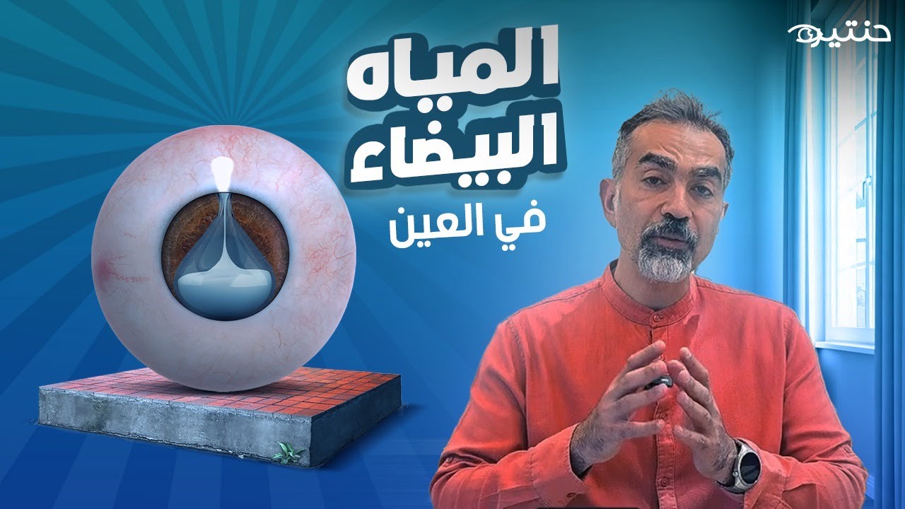 "المياه البيضاء في العين 👁️ الأعراض ومتى تحتاج للعملية؟ 💡