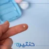 العدسات الصلبة للقرنية المخروطية