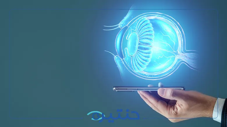 خيارات علاج القرنية المخروطية