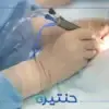 سحب المياه البيضاء بالميكروسكوب الجراحي عبر ثقب