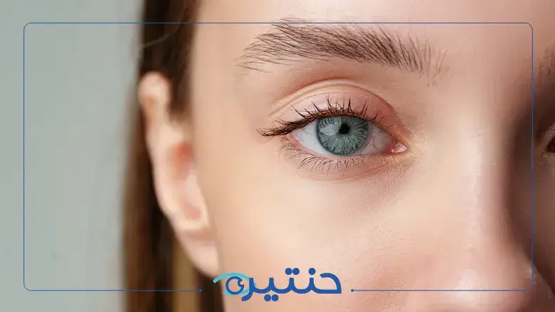 كسل العين
