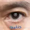 نصائح بعد عملية المياه البيضاء
