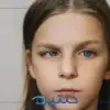 هل الانحراف بالعين يعني حول؟