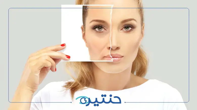 حقن البوتكس تحت العين