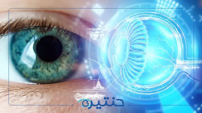 ما هي القرنية المخروطية وطرق علاجها