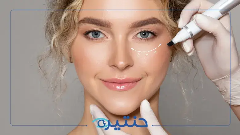 حقن البوتكس تحت العين