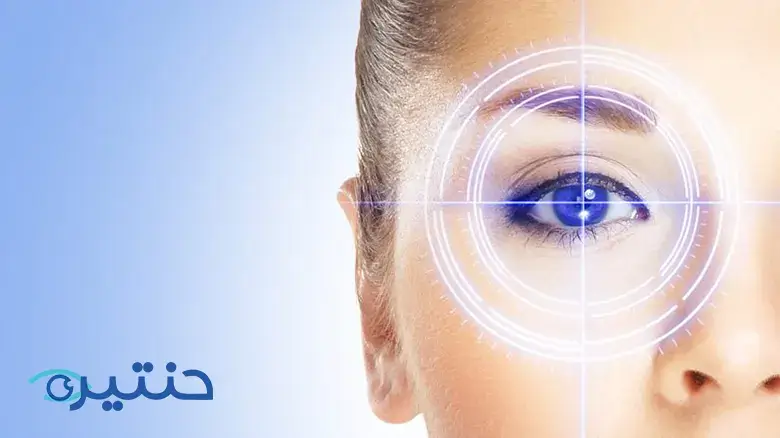 عملية الليزر السطحي بدون لمس No-touch surface laser surgery عملية الليزر السطحي بدون لمس No-touch surface laser surgery