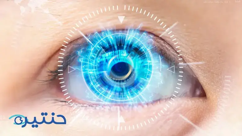 عملية المياه الزرقاء Glaucoma surgery عملية المياه الزرقاء Glaucoma surgery