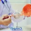 أحدث التطورات في علاج الجلوكوما في 2025