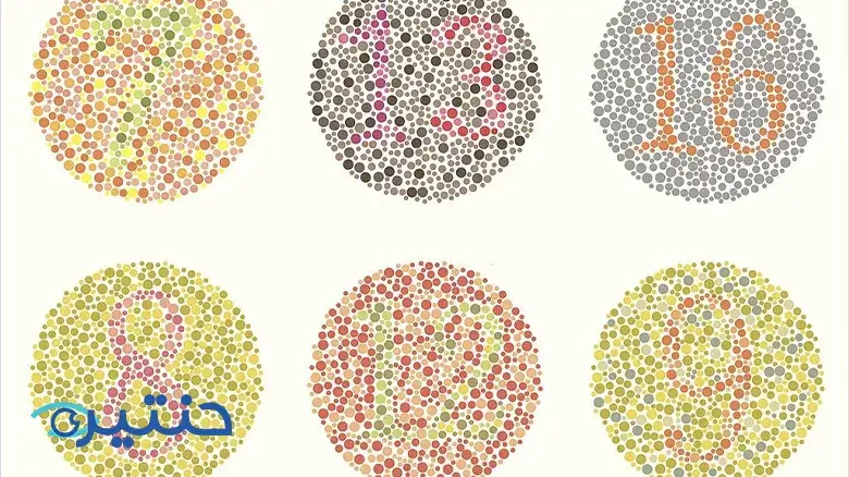 تشخيص وعلاج عمى الألوان Diagnosis and treatment of color blindness تشخيص وعلاج عمى الألوان Diagnosis and treatment of color blindness