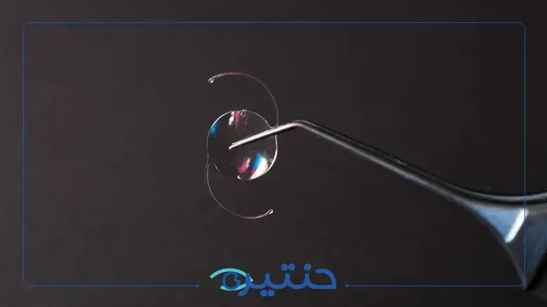 زراعة العدسات داخل العين ICL كبديل لليزك