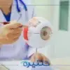 كيف تحمون عيونكم من مضاعفات اعتلال الشبكية السكري؟
