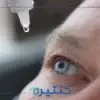 الغمش السمي
