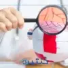 اعتلال الشبكية السكري