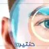السوبراكور ليزك