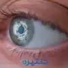 العدسات اللاصقة الذكية
