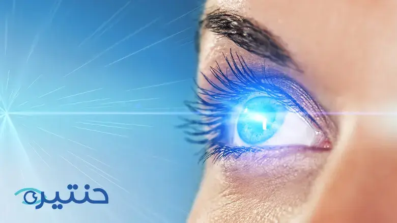 عملية تصحيح النظر بالليزر Laser vision correction surgery