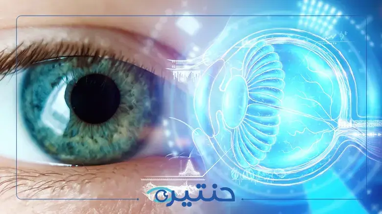 أحدث تقنيات علاج القرنية المخروطية