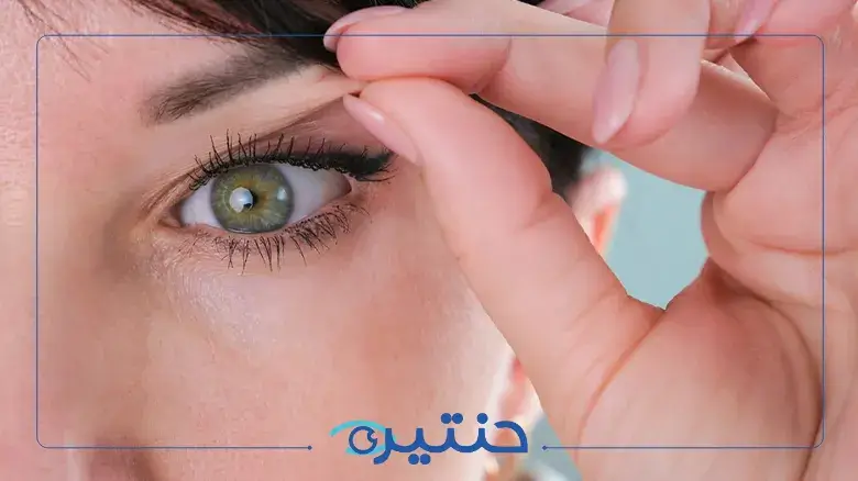 عملية رأب الجفن