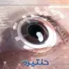 ما هو الفرق بين الليزك والفيمتو سمايل