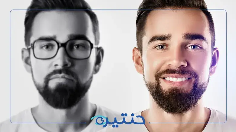 هل يعود النظر 6/6 بعد الليزك