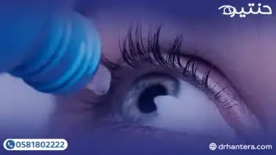 تشخيص التهاب القرنية