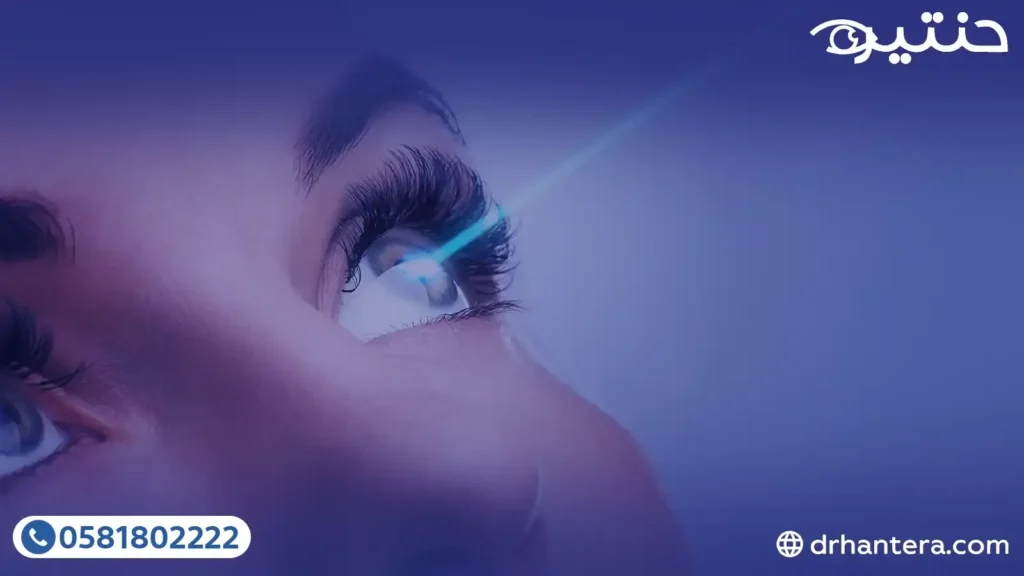 3 أسباب دفعت طبيبة أسنان لإجراء السوبراكور ليزك