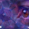 التهاب القرنية البكتيري