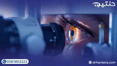 تشخيص التهاب القرنية