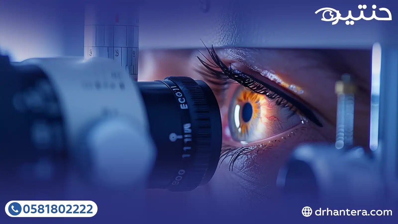 تشخيص التهاب القرنية