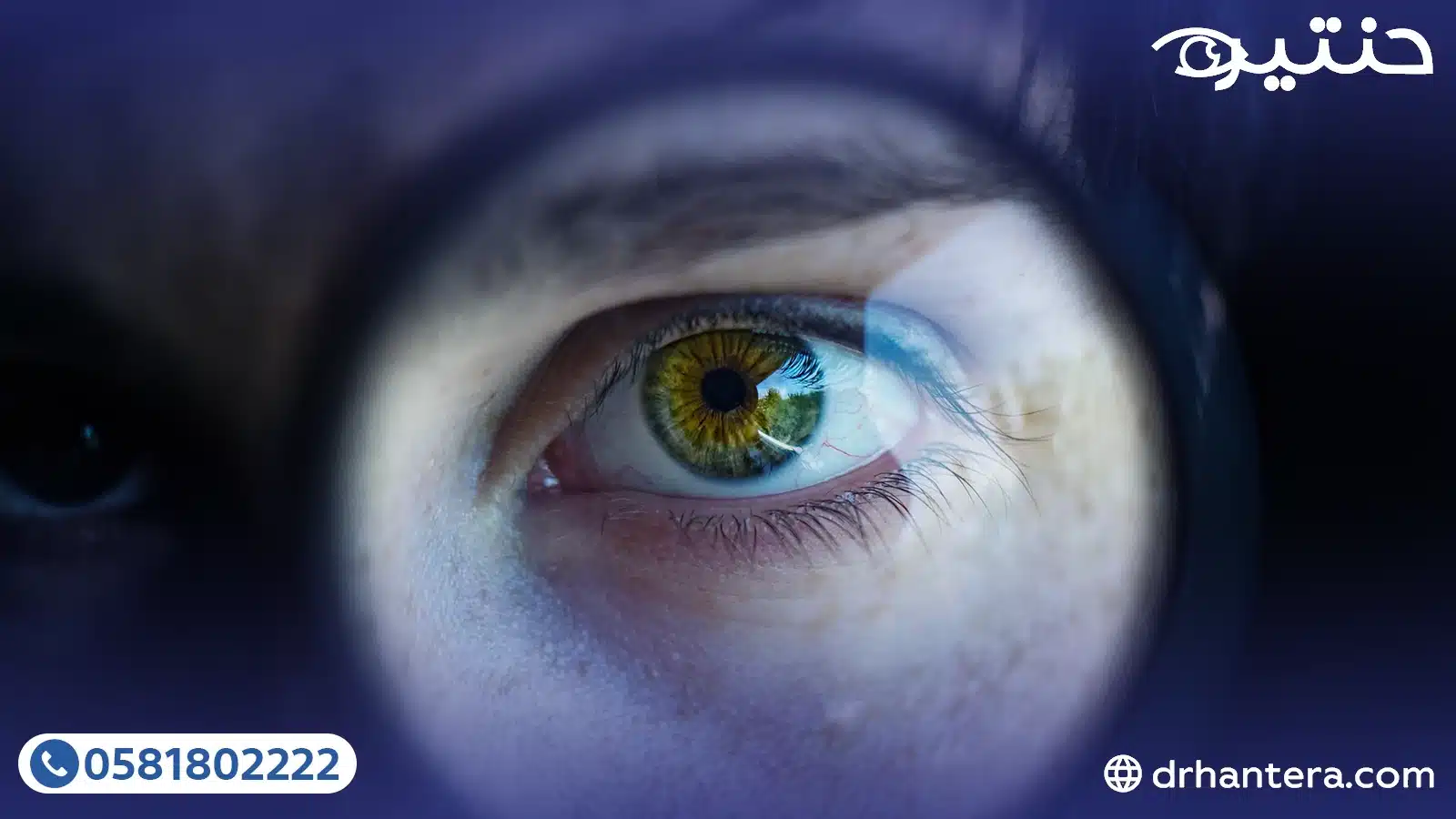 جودة الرؤية بعد الليزك