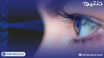 علاج قصر النظر الشديد