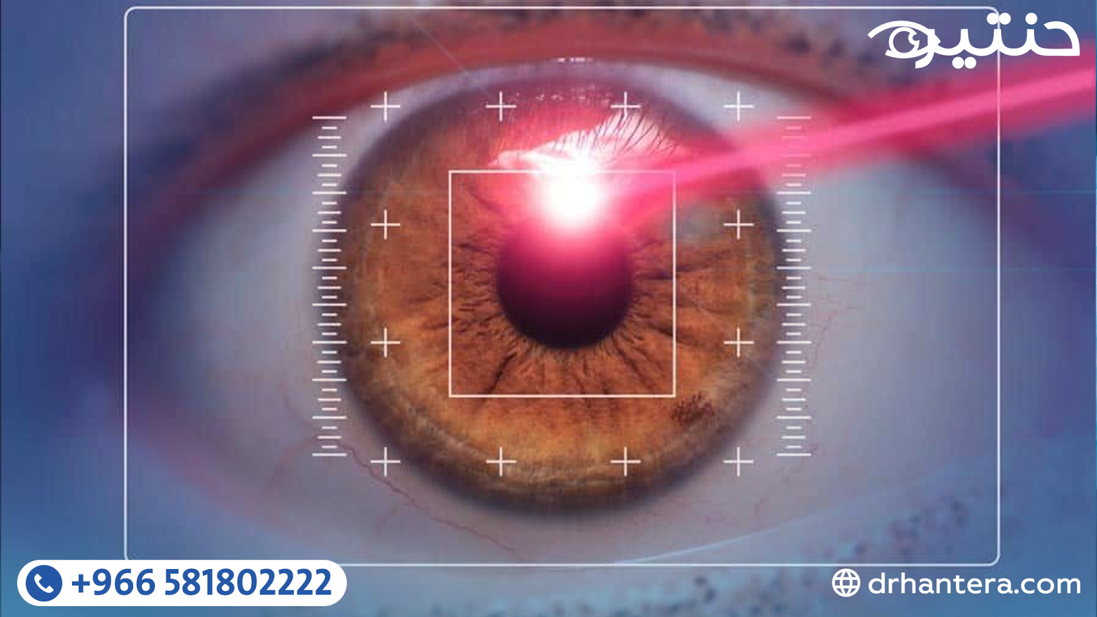 تطور عمليات تصحيح الإبصار من الليزك التقليدي إلى ثورة الفيمتو سمايل