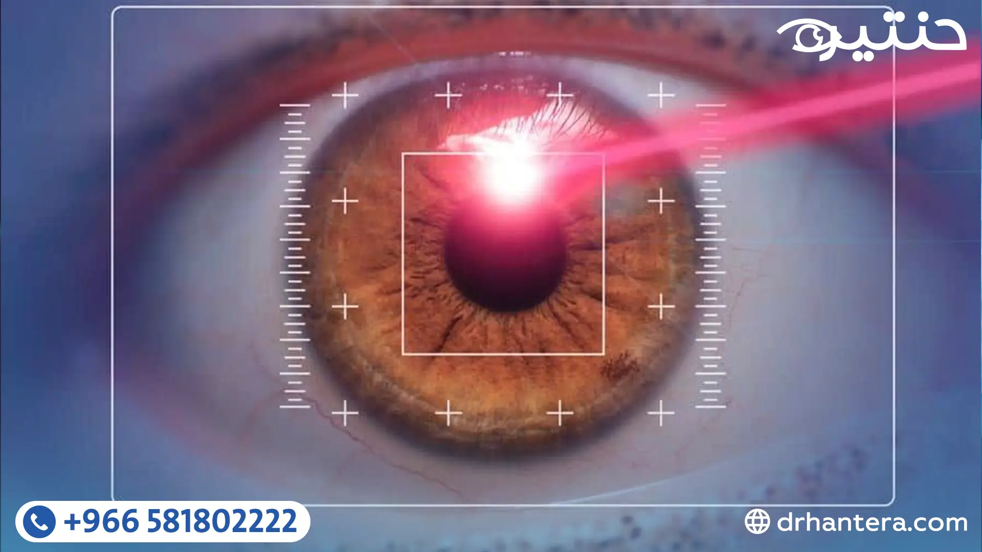 تطور عمليات تصحيح الإبصار من الليزك التقليدي إلى ثورة الفيمتو سمايل