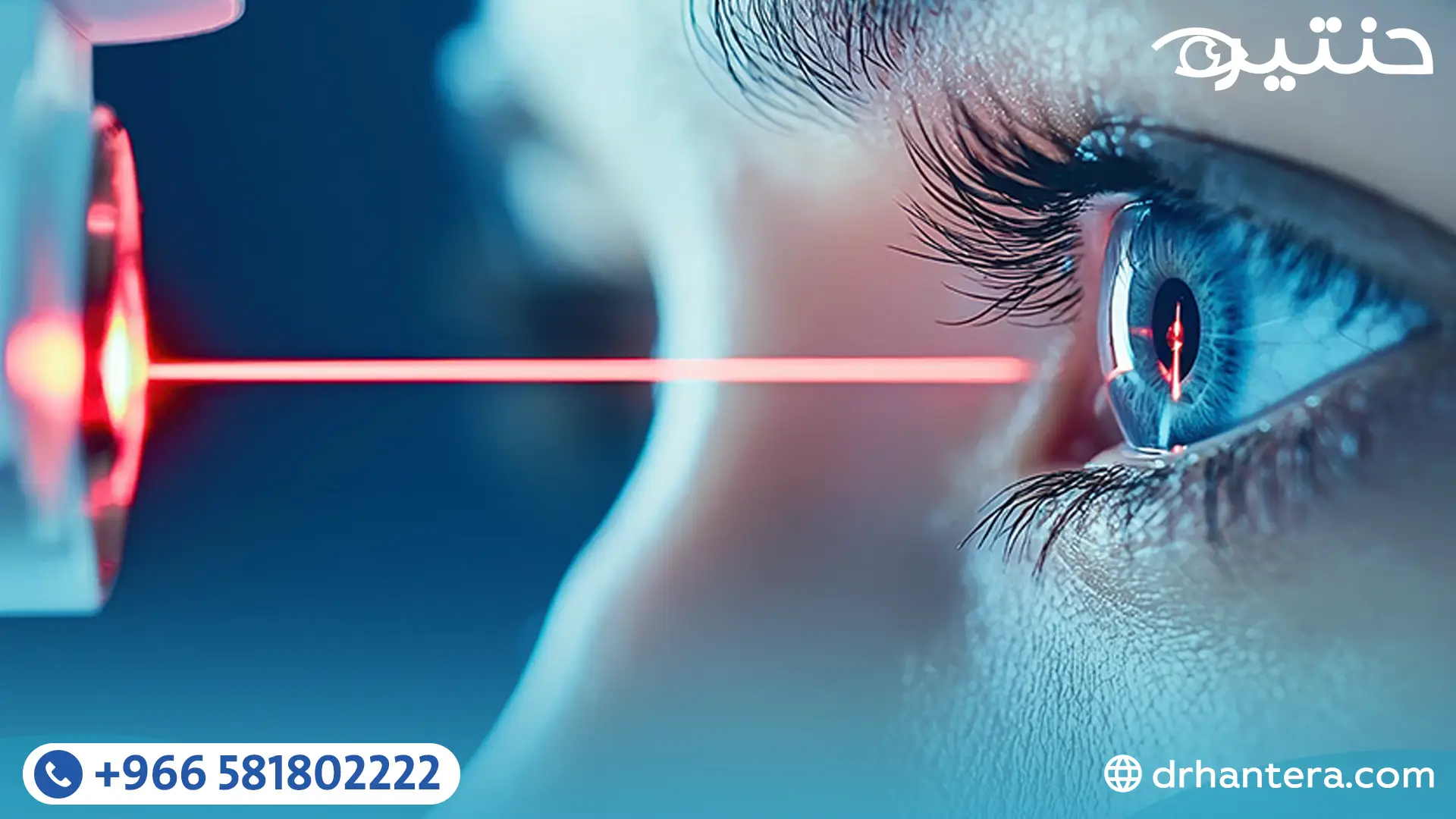 4 أشياء مهمة يجب معرفتها قبل الليزر أو الفيمتو سمايل