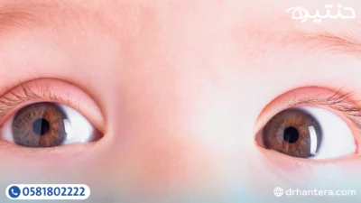 هل لون عين الطفل بيتغير مع الوقت؟ وإمتى يستقر اللون النهائي؟ 1 هل لون عين الطفل بيتغير مع الوقت؟ وإمتى يستقر اللون النهائي؟