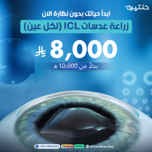 زراعة عدسات ICL