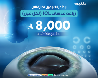 زراعة عدسات ICL