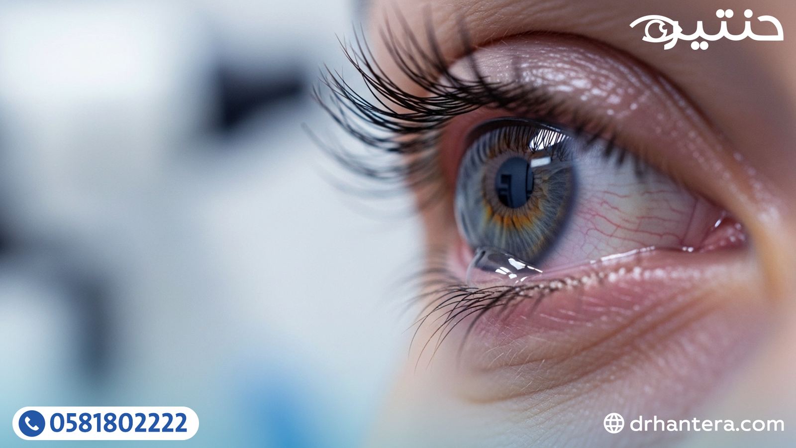 ثلاثة ألوان لإفرازات العين قد تغيّر التشخيص بالكامل