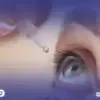 حساسية العين في 2026 كيف تميّزها؟ ولماذا الحكة هي العلامة الفارقة؟
