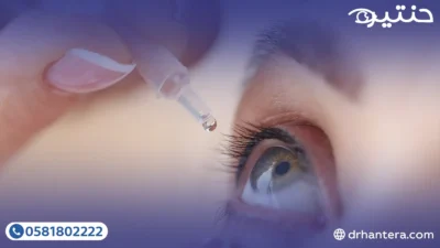 حساسية العين في 2026 كيف تميّزها؟ ولماذا الحكة هي العلامة الفارقة؟