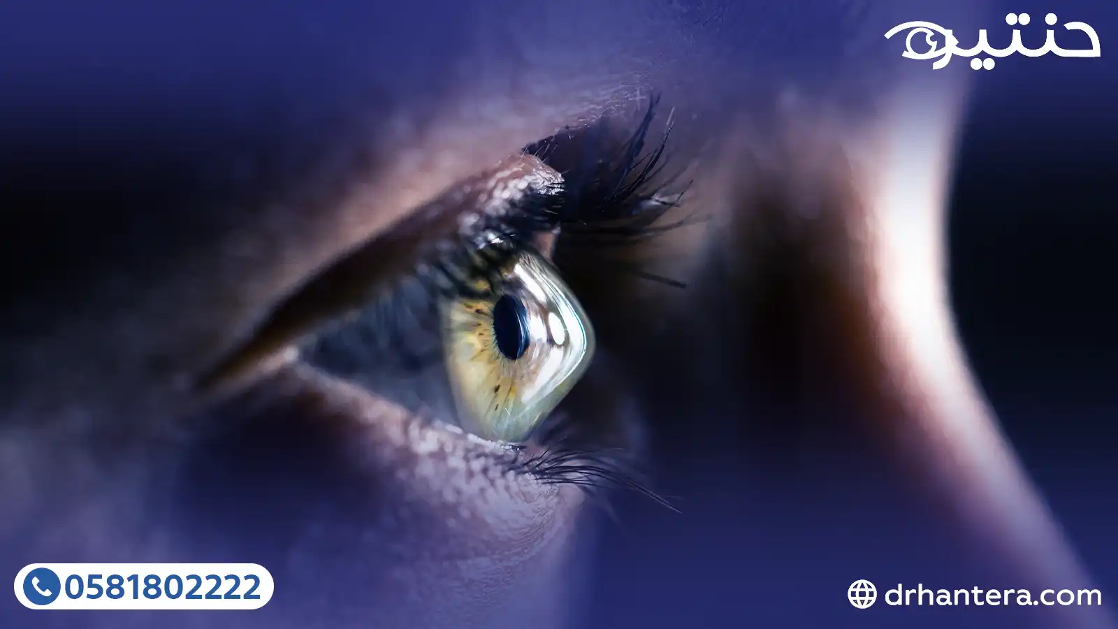 علاج القرنية المخروطية في 2026 الدليل الشامل من التشخيص إلى الرؤية الواضحة