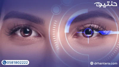 عمليات التصحيح التكميلية (LASIK Enhancement): لمسة أخيرة لرؤية مثالية في 2026