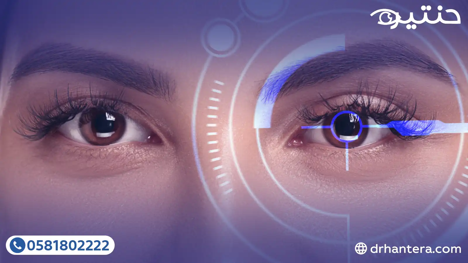 عمليات التصحيح التكميلية (LASIK Enhancement): لمسة أخيرة لرؤية مثالية في 2026