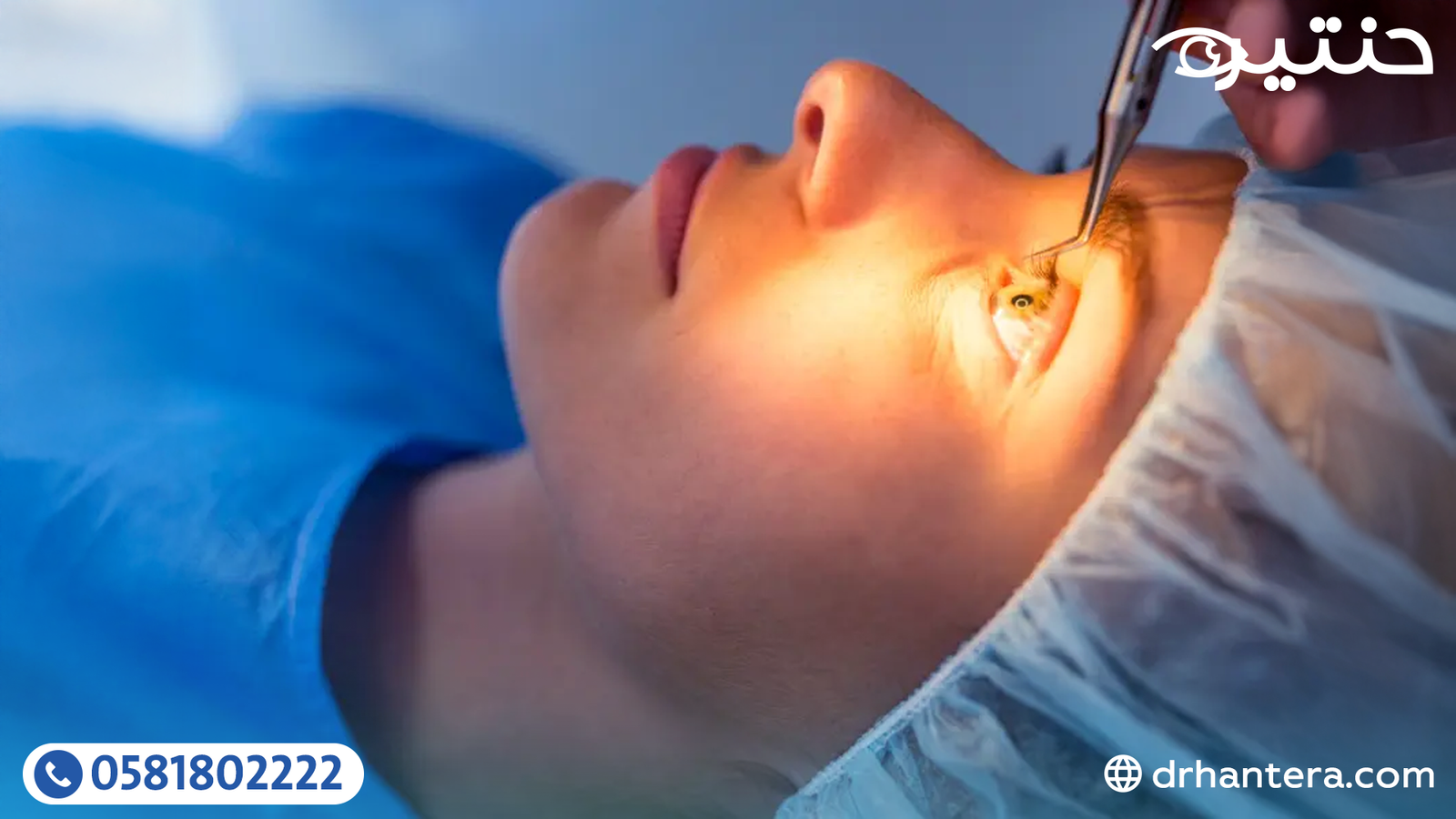 لماذا أُفضّل عملية الفيمتو سمايل في تصحيح الإبصار؟