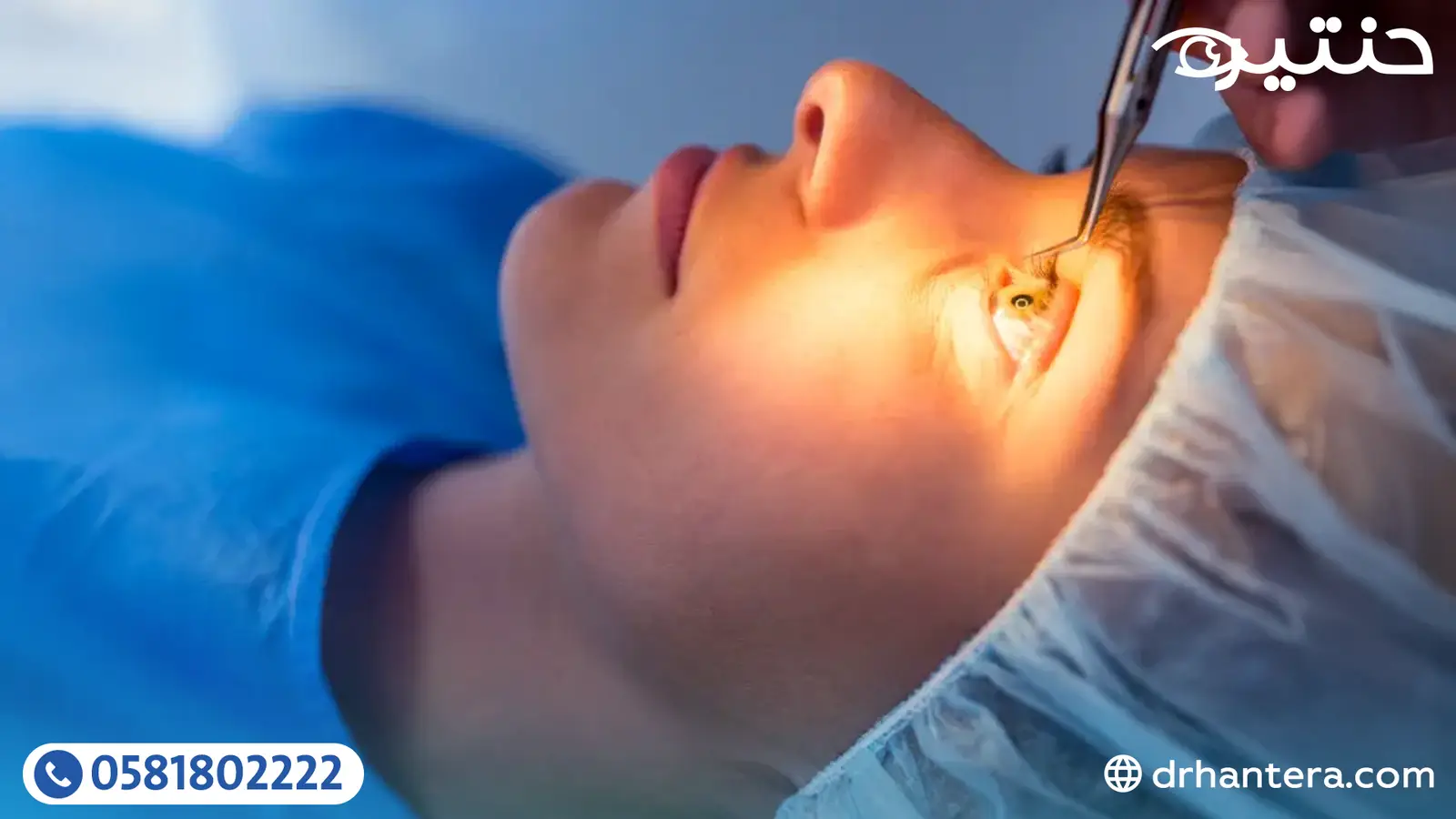 لماذا أُفضّل عملية الفيمتو سمايل في تصحيح الإبصار؟