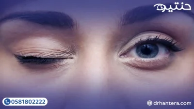 لماذا ترفّ عينك؟ الدليل الشامل لأسباب وحلول رفة الجفن في 2026