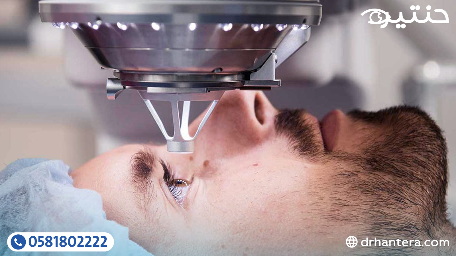 لماذا يفضّل الأطباء عملية الفيمتو سمايل في تصحيح قصر النظر؟