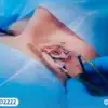 قبل عملية تصحيح الإبصار 5 نصائح ذهبية