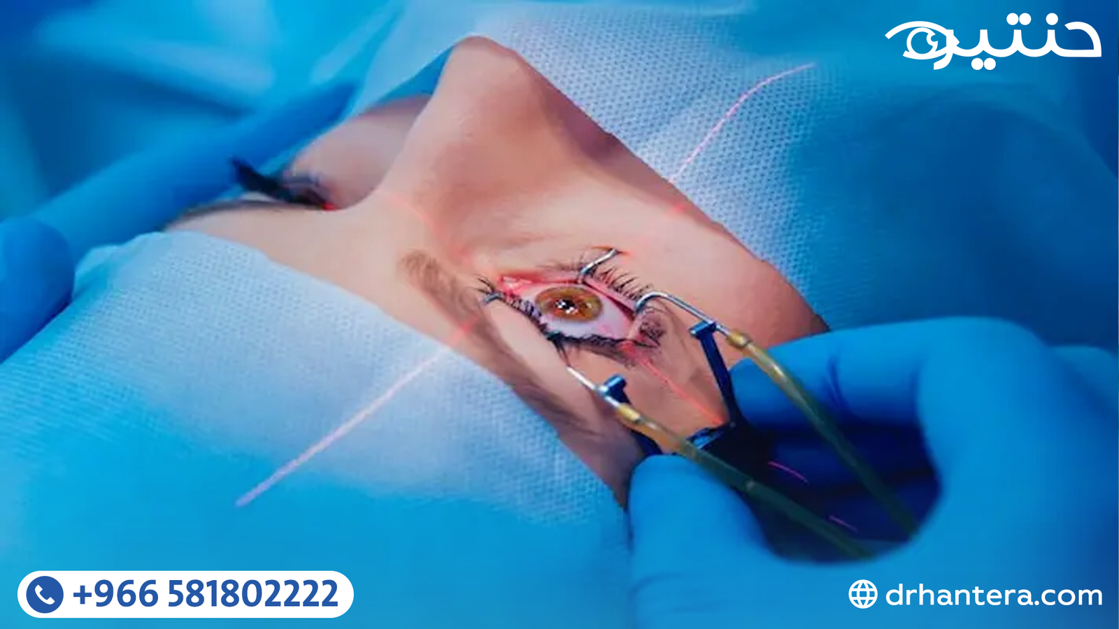 قبل عملية تصحيح الإبصار 5 نصائح ذهبية